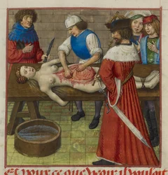 Nero Watching as His Mother Agrippina is Dissected