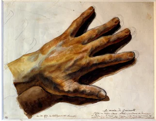 Hand of Gericault