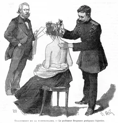 Professor Bergmann Injecting a Tuberculosis Patient