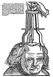 Trephination, 1593