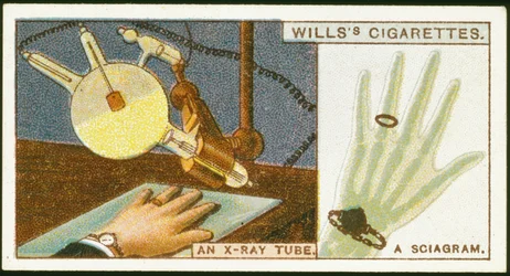 X-raying the hand, 1924