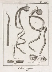 Equipment, Early-Modern Eye surgery