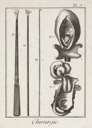 Early-Modern Surgical Instruments and Diagrams of Body Parts