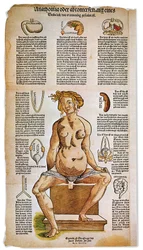 Anatomical board describing the female anatomy from a Renaissance medical treatise