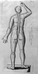 De Acupunctura by W. Ten Rhijne. London 1683. First Western text dealing with Acupuncture
