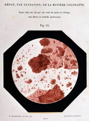 Deposition, by oxidation, of the colouring matter: deposit in a sight which has been emptied for six months without flowers or any disease. 400/1 microscopic view. Study on wine 1866 by Pasteur