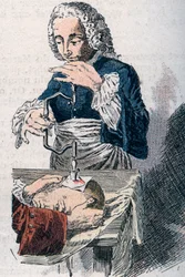 The Trepanation. 18th century print.