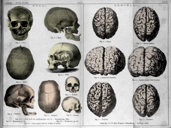 The skins and brains of genius men. Study of Cesare Lombroso, Italian criminologist in 