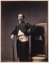 Major H. A. Barnum, Recovery after a Penetrating Gunshot Wound of the Abdomen with Perforation of the Left Ilium, from the Photographic Catalogue of the Surgical Section
